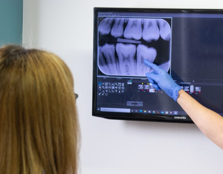 Dentist showing a patient an x-ray of their teeth